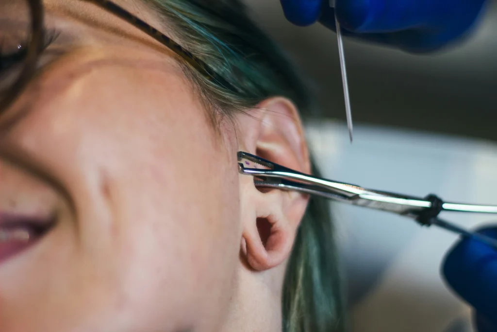 dermal piercing 